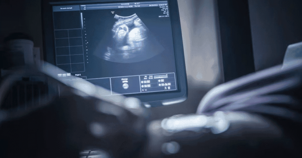 Tips for Success in Your Ultrasound Tech Career